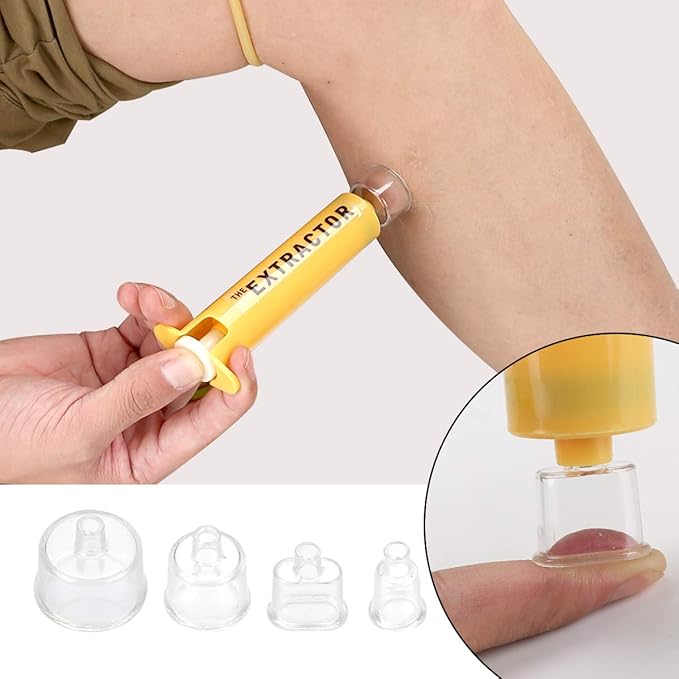 Snake Bite Kit, Bee Sting Kit, Emergency First Aid Supplies, Venom Extractor Suction Pump, Bite and Sting First Aid for Hiking, Backpacking and Camping