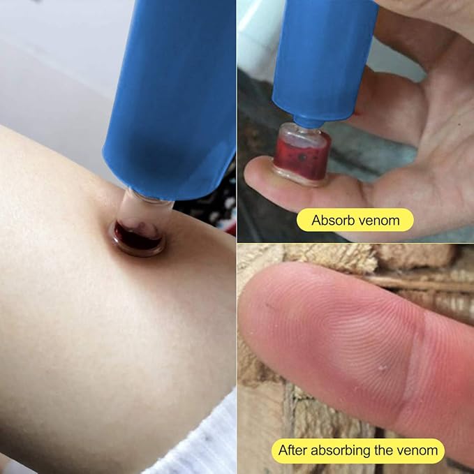 Snake Bite Kit, Bee Sting Kit, Emergency First Aid Supplies, Venom Extractor Suction Pump, Bite and Sting First Aid for Hiking, Backpacking and Camping