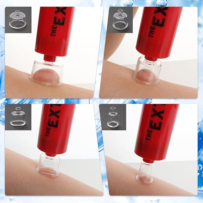 Snake Bite Kit Sting Kit Venom Extractor Suction Pump Emergency Sting Bite Kit First Aid Supplies for Backpacking Camping and Hiking (Red)