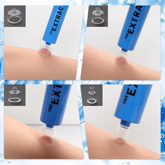 Snake Bite Kit Bee Sting Kit Venom Extractor Suction Pump Emergency Sting Bite Kit First Aid Supplies for Backpacking Camping and Hiking