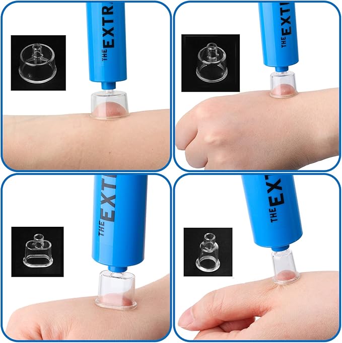 Snake Bite Kit, Bee Sting Kit, Emergency First Aid Supplies, Venom Extractor Suction Pump, Bite and Sting First Aid for Hiking, Backpacking and Camping. Includes Bonus CPR face Shield (Blue)